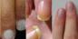 Mira las uñas. 12 Estas desviaciones pueden decir mucho acerca de su salud