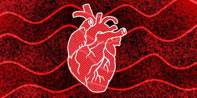 11 señales de que puede ocurrir un paro cardíaco