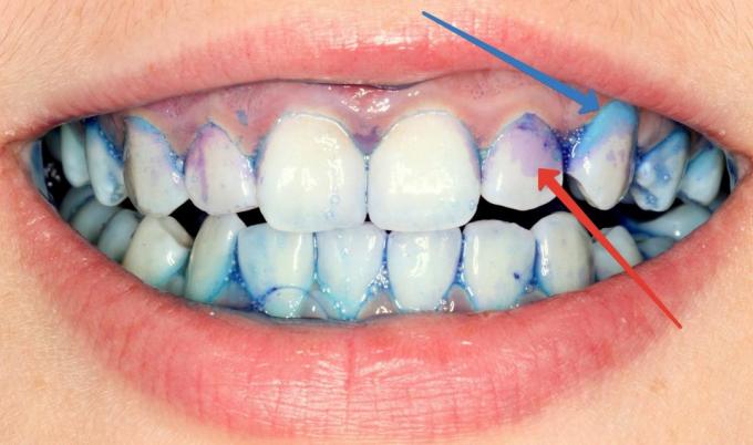 Cómo cuidar de los dientes