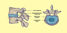 ¿De dónde viene la hernia de la columna vertebral y qué hacer