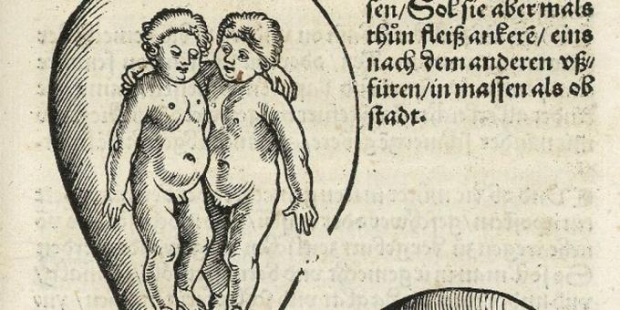 Niños de la Edad Media: gemelos en el útero, Eucharius Rodion