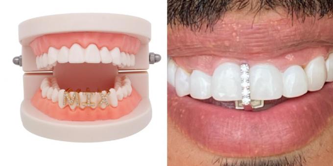 Cosas más extrañas con AlIExpress: corona dental 