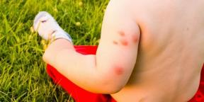 Qué hacer si es alérgico a las picaduras de mosquitos y mosquitos