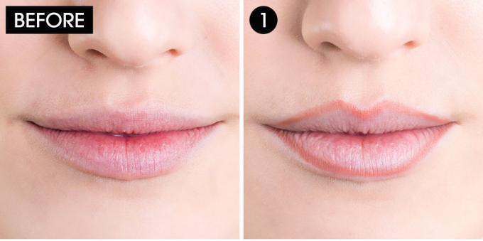 ¿Cómo reducir el labio