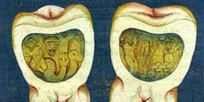 Medicina medieval: una página del tratado dental otomano, siglo XVII.